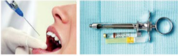 胰島素，牙科麻醉6.png